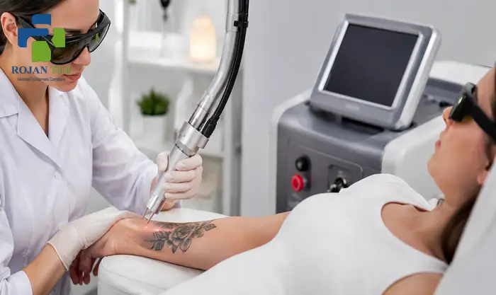 آموزش لیزر حذف تاتو در مشهد